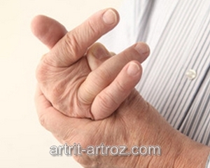 человек сгибает палец на руке