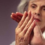Ревматоидный артрит: фото внешних признаков и симптомов