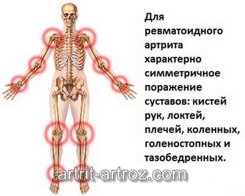 строение суставов человека