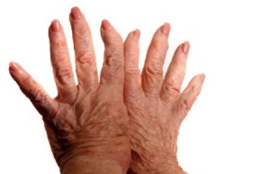 больные пальцы рук