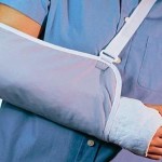 Перелом руки со смещением – лечение и реабилитация