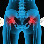 Остеоартрит и остеоартроз воспалительного происхождения почему возникает?